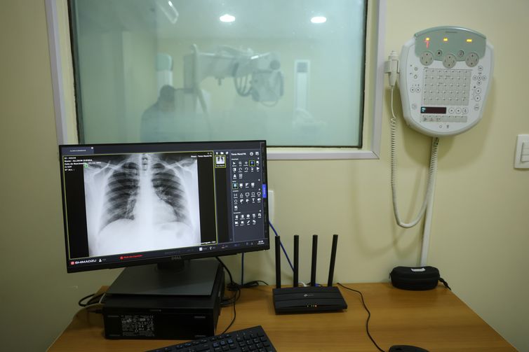 Brasil tem aumento de hospitalizações por Influenza A, alerta Fiocruz